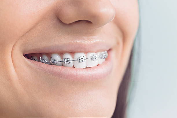Best Teeth Whitening  in Ashland, OR